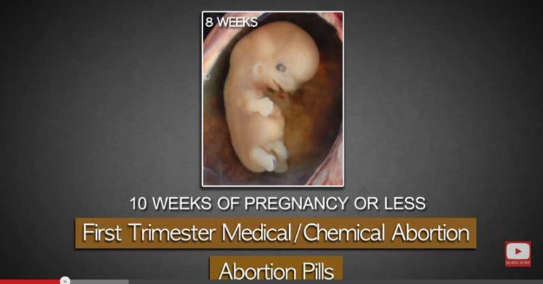 WATCH: Former abortionist shows RU-486 abortion