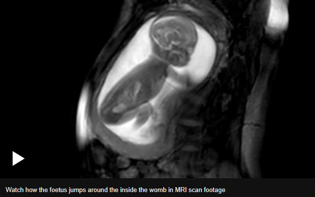 Detailed images of baby heart inside the womb