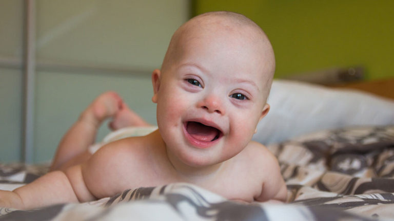 Parents fighting to give birth to Down syndrome children